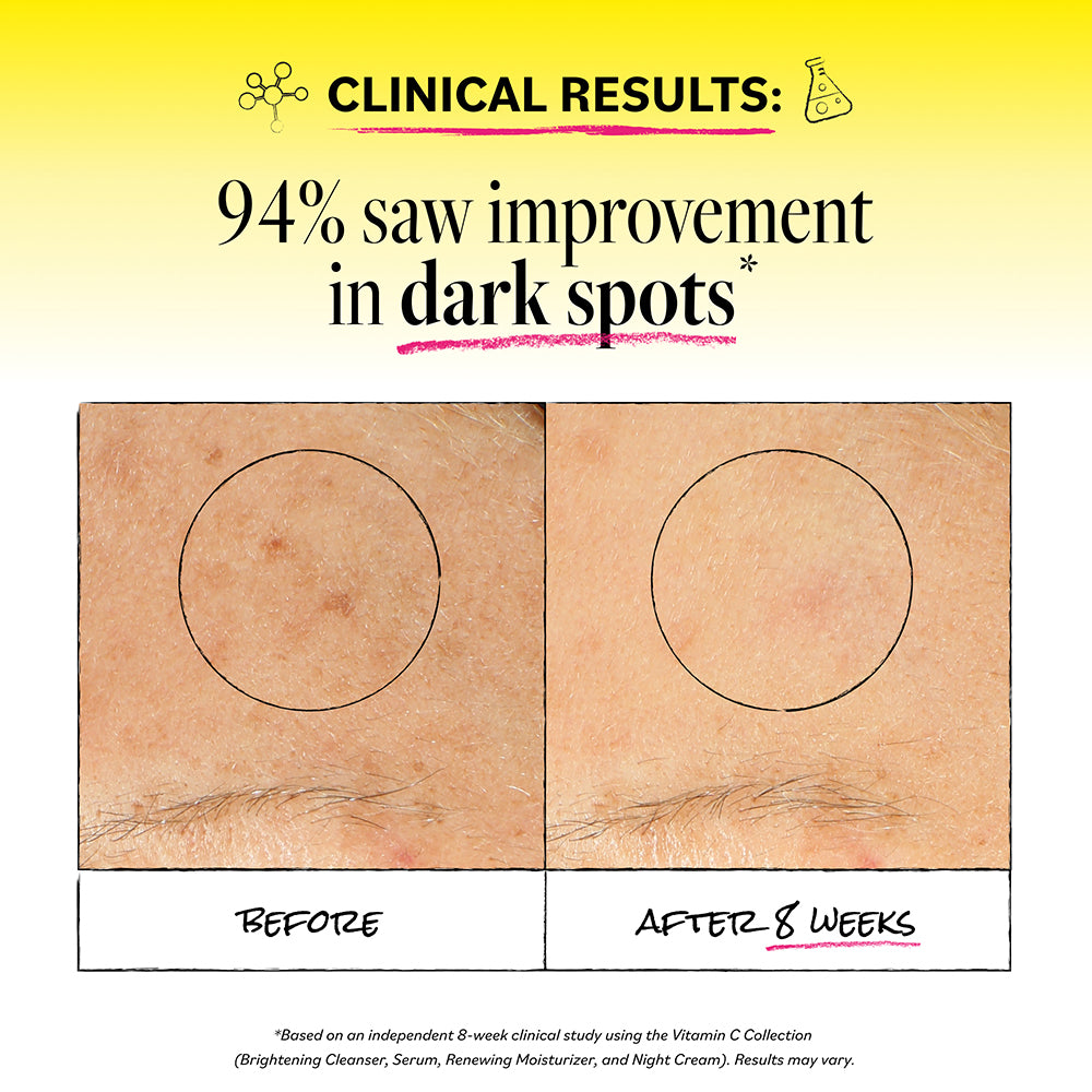 0360_ClinicalResults.jpg